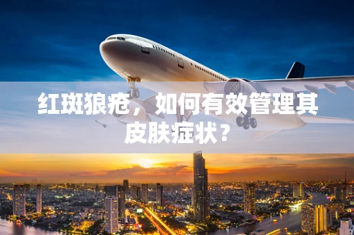 红斑狼疮，如何有效管理其皮肤症状？