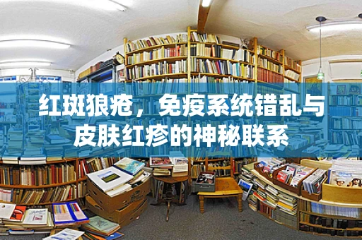 红斑狼疮，免疫系统错乱与皮肤红疹的神秘联系