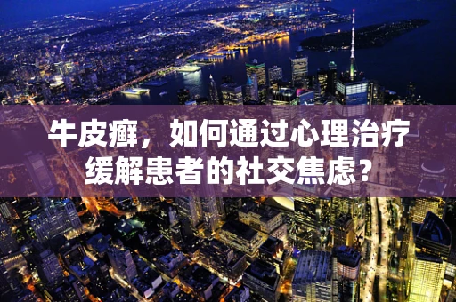 牛皮癣，如何通过心理治疗缓解患者的社交焦虑？